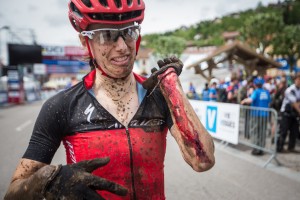 After a bad crash in France, Davison got up, pulled her injured bike and arm together and finished. The arm took six stitches. 